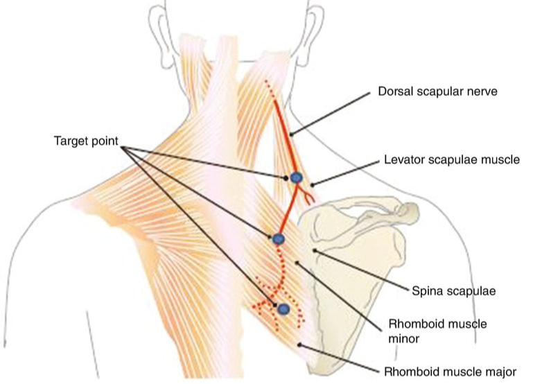 dorsal scapular nerve cadaver